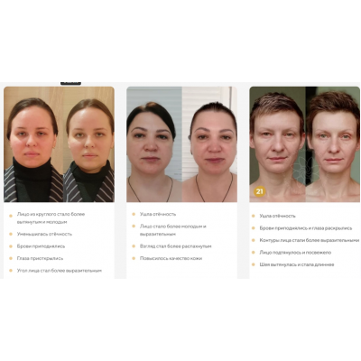 Отекам Нет. Январь 2022. Алесь Улищенко Международная Академия фейспластики и остеопатии Отекам Нет. Январь 2022. Алесь Улищенко Международная Академия фейспластики и остеопатии